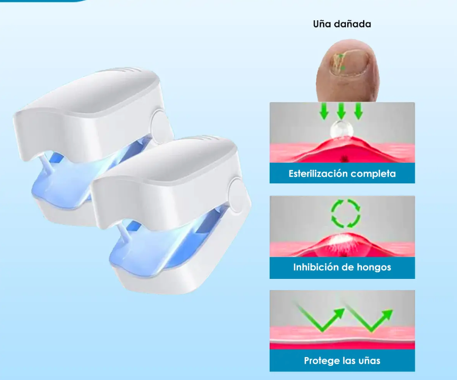 Laser Para Quitar Hongos De Las Uñas. (Onicomicosis Láser)®