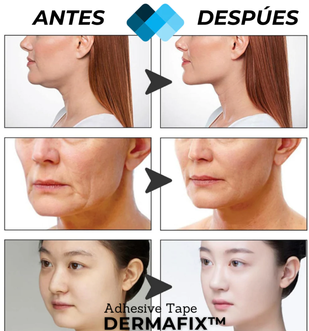 (PACK 40 Unidades) Tiras de Lifting facial efecto Natural V-shaped™