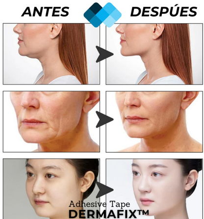 (PACK 40 Unidades) Tiras de Lifting facial efecto Natural V-shaped™