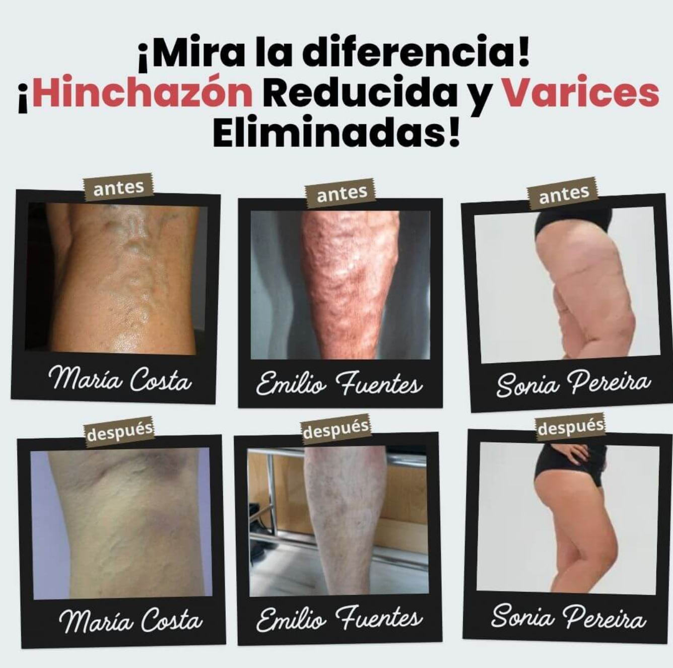 Calcetines de acupresión©