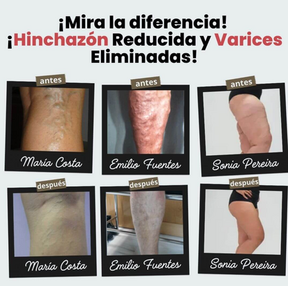 Calcetines de acupresión©