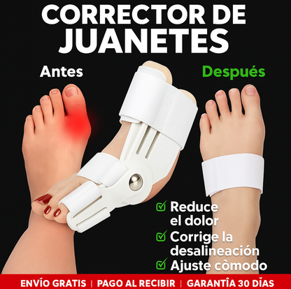 Corrector de Juanetes  Bonex Bunion Fix™