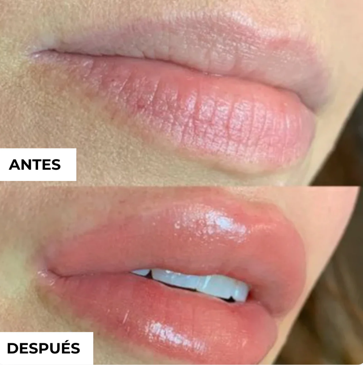 VOLUMINIZADOR LABIOS CON COLAGENO