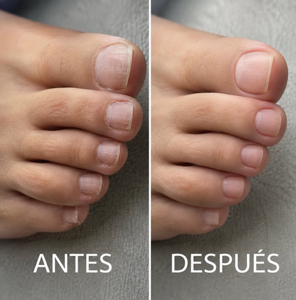 NailRestore™ – Esmalte Reparador y Fortalecedor de Uñas