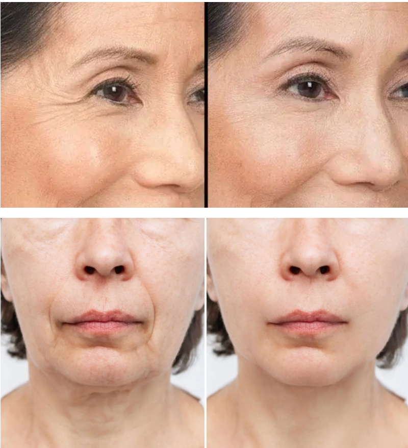Suero Facial Anti-Edad 'Efecto Lifting' para Arrugas y Flacidez