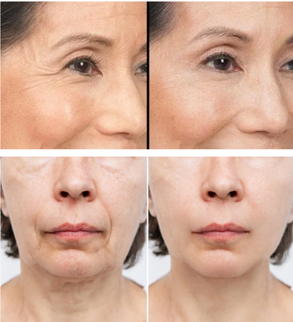 Suero Facial Anti-Edad 'Efecto Lifting' para Arrugas y Flacidez