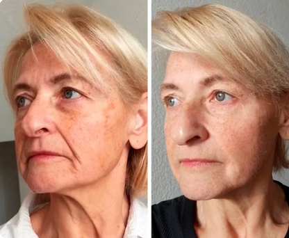 Suero Facial Anti-Edad 'Efecto Lifting' para Arrugas y Flacidez
